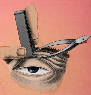 Correction: Surgery to Correct Lazy Eyelid, 1830