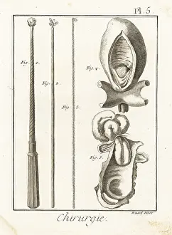 Hernia: Surgical instruments to remove foreign bodies