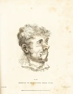 Gums: Surgical operation on the tumor in the cheek of Mr Taylor