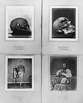 55th: Surgical photograph... prepared under the supervision of
