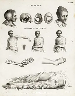 Farey: Surgical procedures from the 19th century