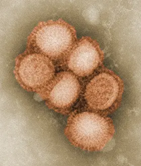 Microbes: Swine flu virus. Colorized negative stained ?