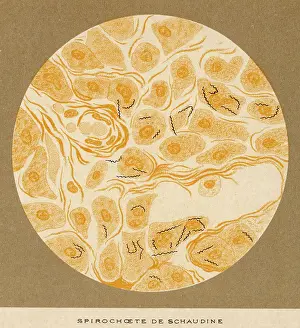 Ailments: SYPHILIS SPIROCHAETE