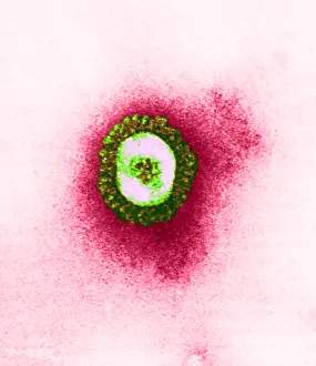 Virus: TEM of Coronavirus
