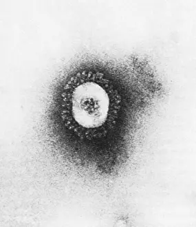Virus: TEM of Coronavirus