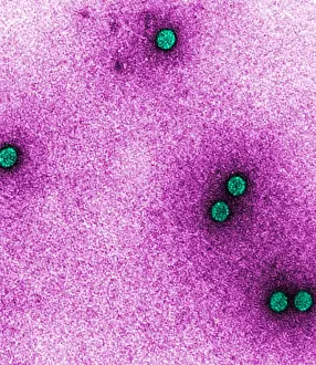 Microscopy: TEM of Rhinoviruses