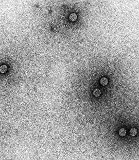 Virus: TEM of Rhinoviruses