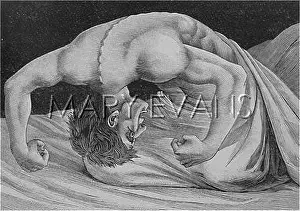 Convulsions: TETANUS VICTIM - 2