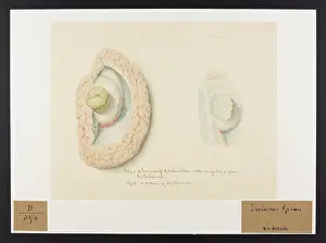 Tubercle: Thalmus Opticus: Tubercle