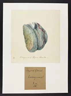 Ucl Library Services Digital Collections: Thyroid Gland