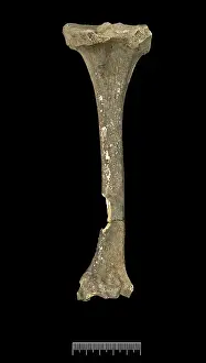 Tibia: Tibia of Achondroplastic Dwarf