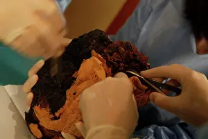 Franais: Tissue sampling operation of an Egyptian mummy
