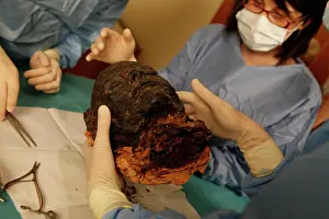 Franais: Tissue sampling operation of an Egyptian mummy