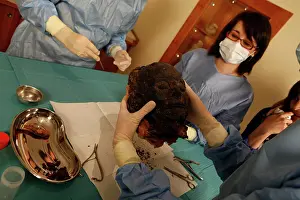 Franais: Tissue sampling operation of an Egyptian mummy