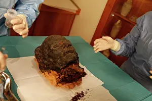 Franais: Tissue sampling operation of an Egyptian mummy