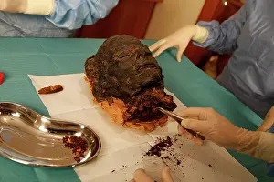 Franais: Tissue sampling operation of an Egyptian mummy