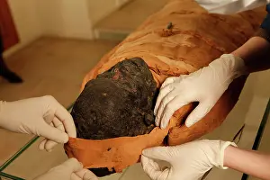 Franais: Tissue sampling operation of an Egyptian mummy