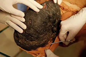Franais: Tissue sampling operation of an Egyptian mummy
