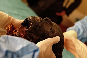 Franais: Tissue sampling operation of an Egyptian mummy