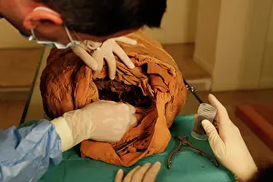 Franais: Tissue sampling operation of an Egyptian mummy