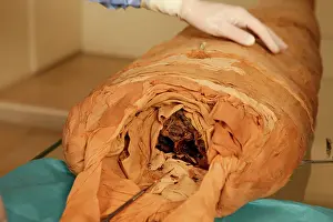 Franais: Tissue sampling operation of an Egyptian mummy