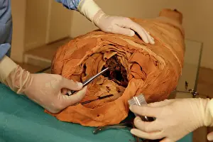 Franais: Tissue sampling operation of an Egyptian mummy