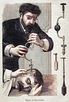 Trepanning: Trepanner on the Job