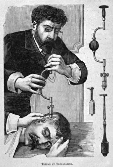 Trepanning: Trepanner on the Job