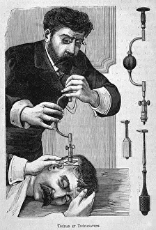Trepanning: Trepanner on the Job