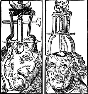 Trephination: Trepanning, 1525