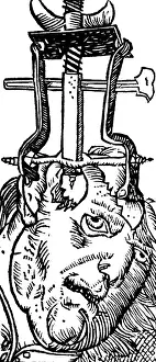 Trephination: Trepanning, 1525