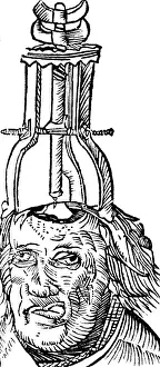 Trephination: Trepanning, 1525