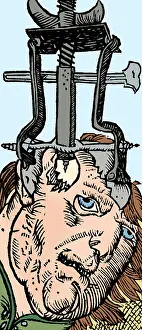 Trephination: Trepanning, 1525