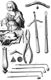 Trephination: Trepanning, 1772