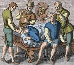 Trephination: Trepanning Being Performed, 1594