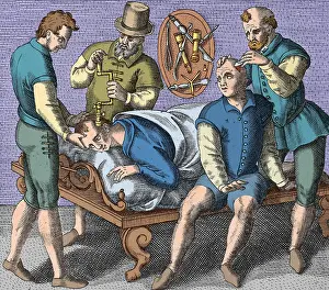 Trephination: Trepanning Being Performed, 1594