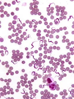 Protozoan: Trypanosomes