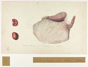 Plantes: Tubercle in Epiploon and Kidney. (Monkey)