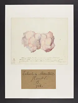 Ucl Library Services Digital Collections: Tubercle in Mesenteric Glands
