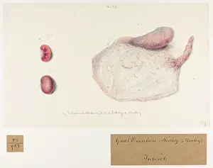 Plantes: Tubercles in Epiploon, Kidneys of Monkey