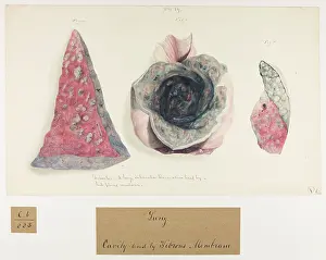 Thick: Tubercles: Large Tubercular Excavation