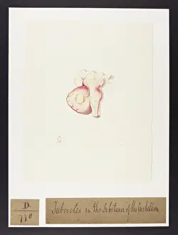 Blank: Tubercles: Substances of the Cerebellum