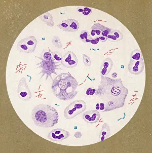 Bacillus: TUBERCULOSIS BACILLUS