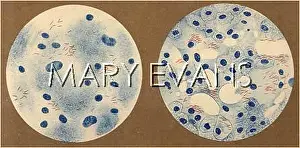 Bacillus: TUBERCULOSIS BACILLUS