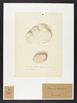 Contained: Tuberculous: Brain and Cerebellum
