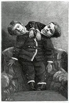 Intelligent: TWO-HEADED BOY