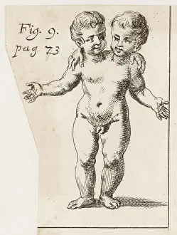 Oddities: TWO-HEADED CHILD/1691