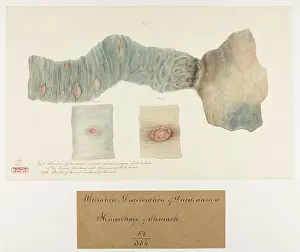 Stomach: Ulceration and Discolouration of Duodenum