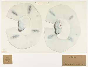 Ulceration: Ulceration of the Ileon
