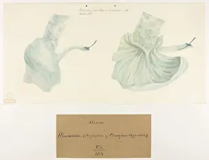 1827: Ulceration of the Ileum